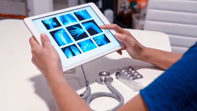 picture-archiving-and-communication-system-pacs